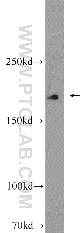 13545-1-AP;human blood tissue