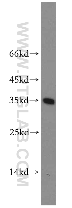 14148-1-AP;mouse liver tissue