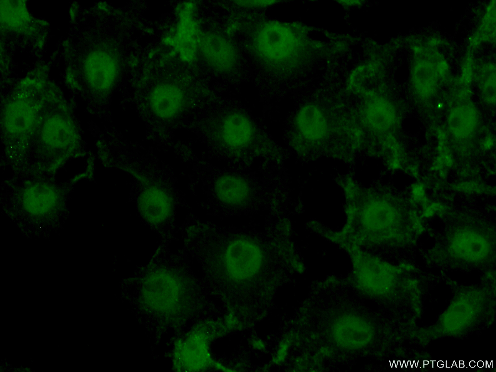 17570-1-AP;SH-SY5Y cells