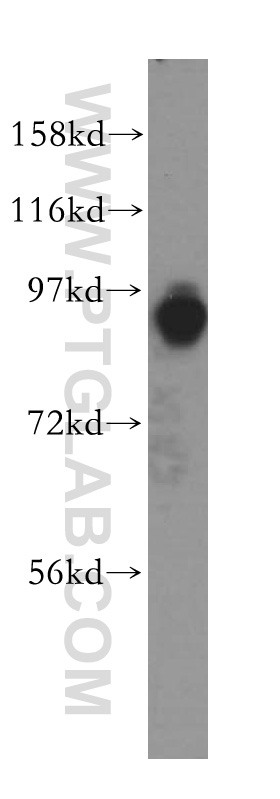 17570-1-AP;Jurkat cell