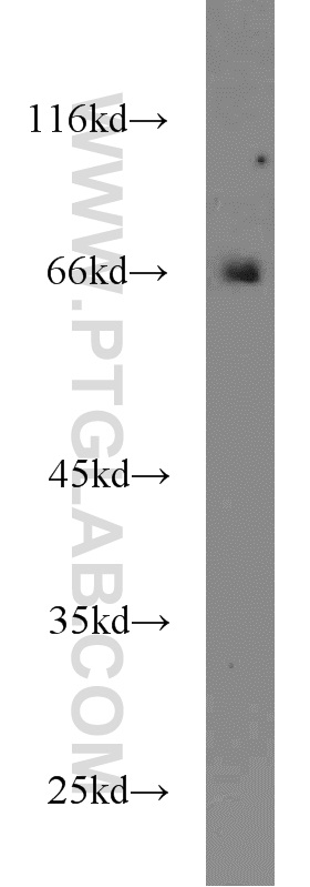 acbd3-antibody-14096-1-ap-proteintech