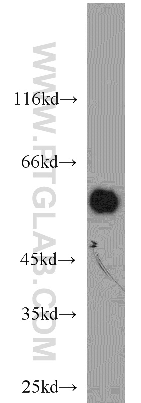 11491-1-AP;MDA-MB-453s cells