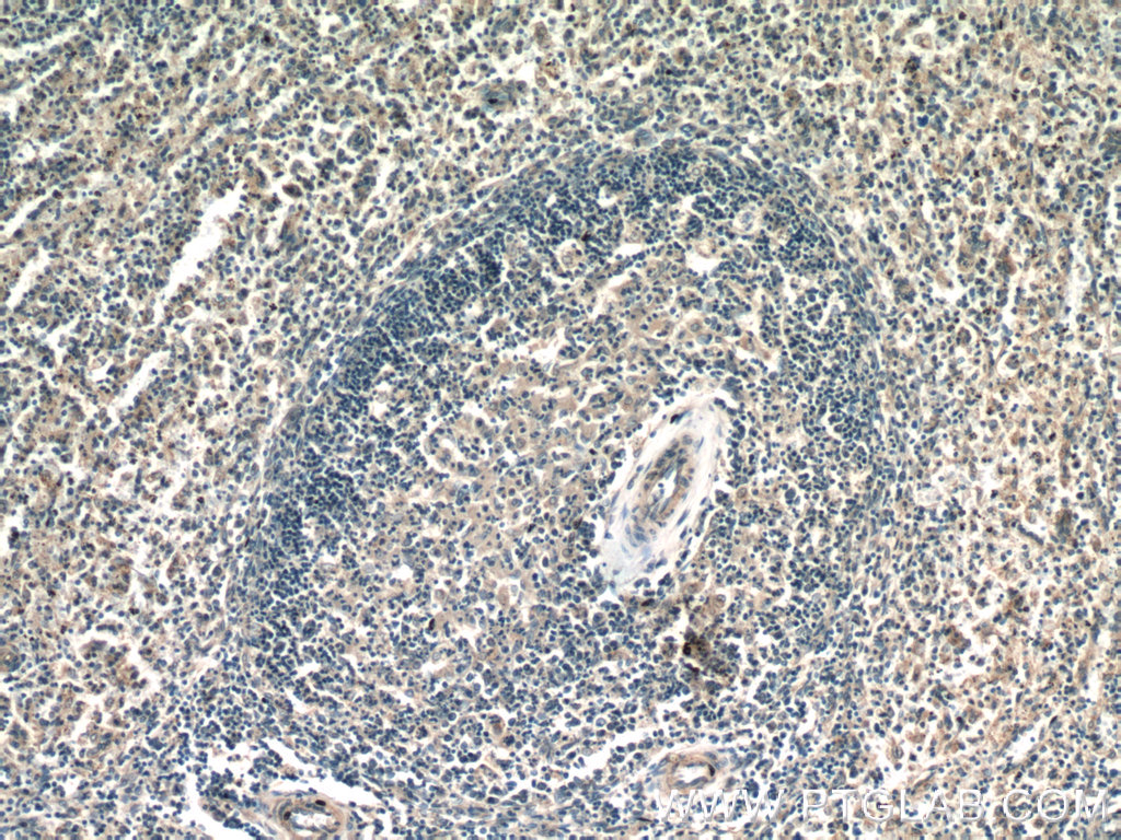 23366-1-AP;human spleen tissue