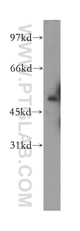 12965-1-AP;human liver tissue