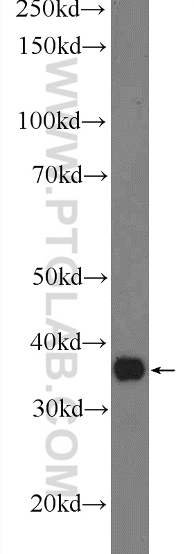 24326-1-AP;mouse liver tissue