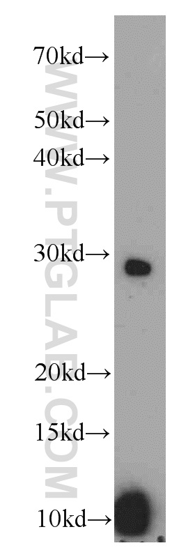 14040-1-AP;DU 145 cells