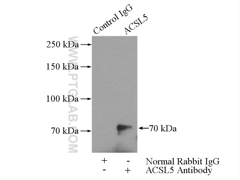 15708-1-AP;mouse brain tissue