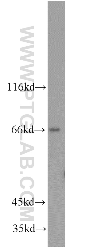 15708-1-AP;mouse brain tissue