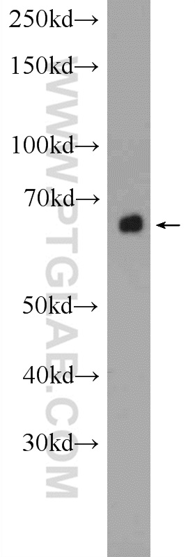 16591-1-AP;mouse liver tissue