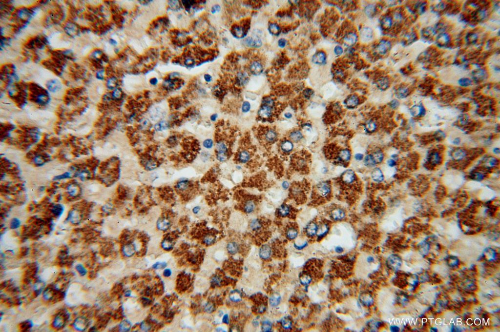 16204-1-AP;human liver