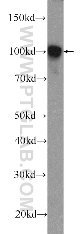 11313-2-AP;C6 cells