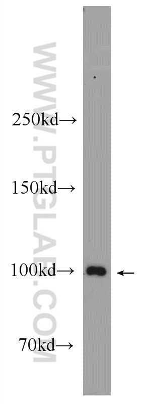 24378-1-AP;mouse skeletal muscle tissue