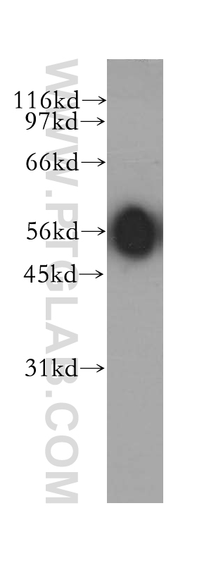 12610-1-AP;mouse testis tissue