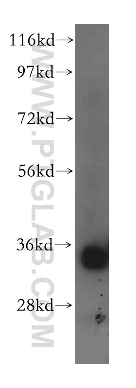 16786-1-AP;mouse liver tissue