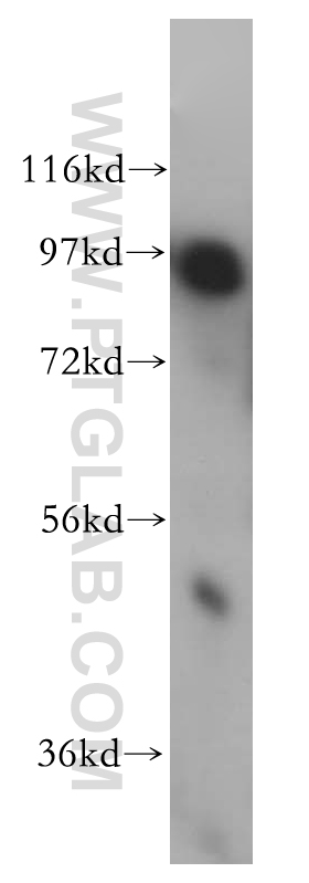 14139-1-AP;mouse brain tissue