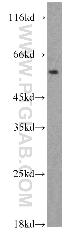 13952-1-AP;mouse testis tissue