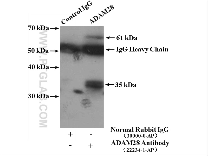 22234-1-AP;mouse lung tissue