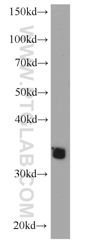 22234-1-AP;mouse lung tissue