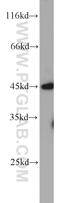 22147-1-AP;HeLa cells