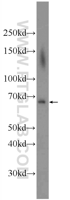 23778-1-AP;BxPC-3 cells