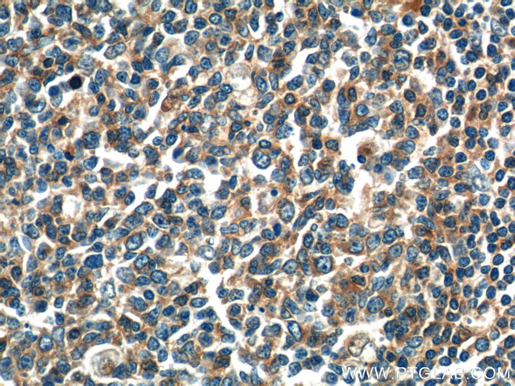 17899-1-AP;human tonsillitis tissue