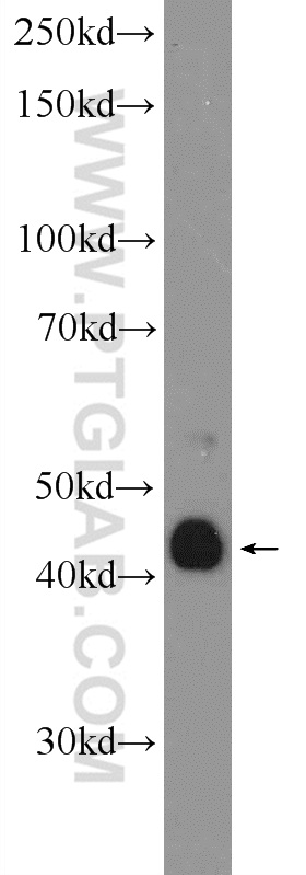 17899-1-AP;MCF-7 cells