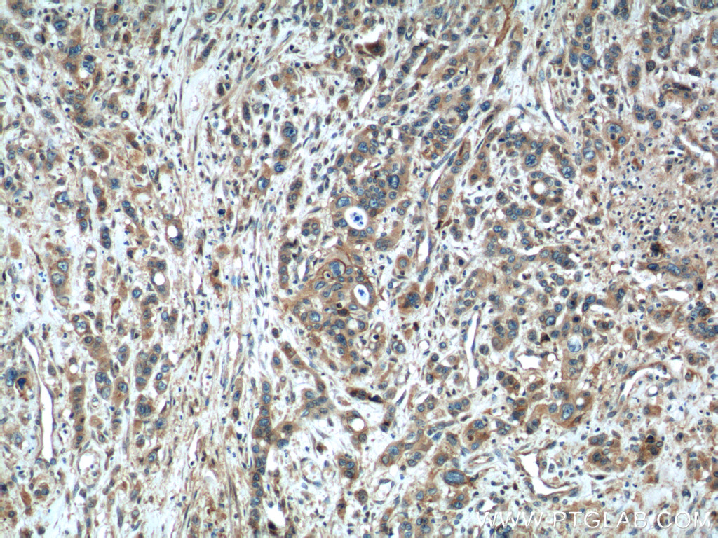 24934-1-AP;human stomach cancer tissue