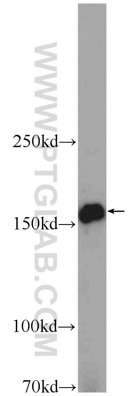 24934-1-AP;mouse placenta tissue