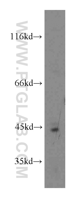 13706-1-AP;human placenta tissue