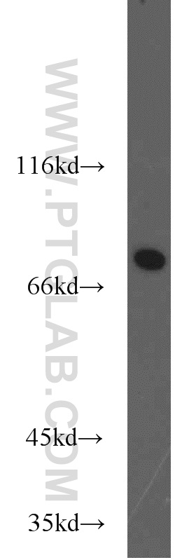 22248-1-AP;rat brain tissue