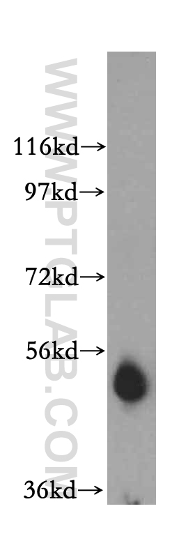 15482-1-AP;human heart tissue