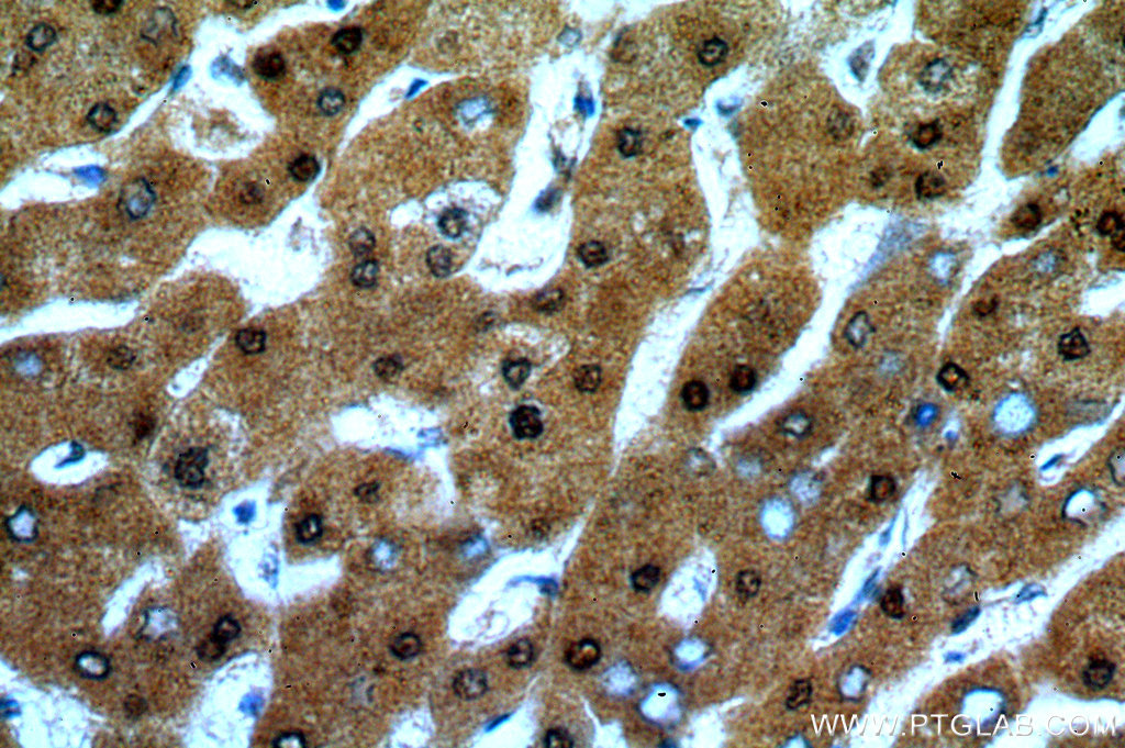 13621-1-AP;Hepatocirrhosis