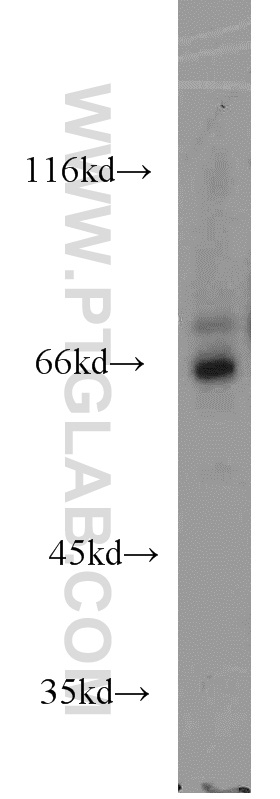 17579-1-AP;mouse brain tissue