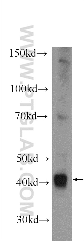 17165-1-AP;mouse liver tissue