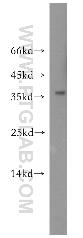 18897-1-AP;mouse liver tissue