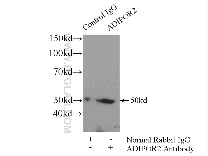 14361-1-AP;HeLa cells