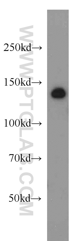 17987-1-AP;HeLa cell