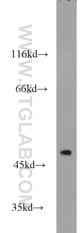 16373-1-AP;mouse skeletal muscle tissue