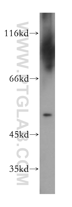 11232-2-AP;human testis tissue