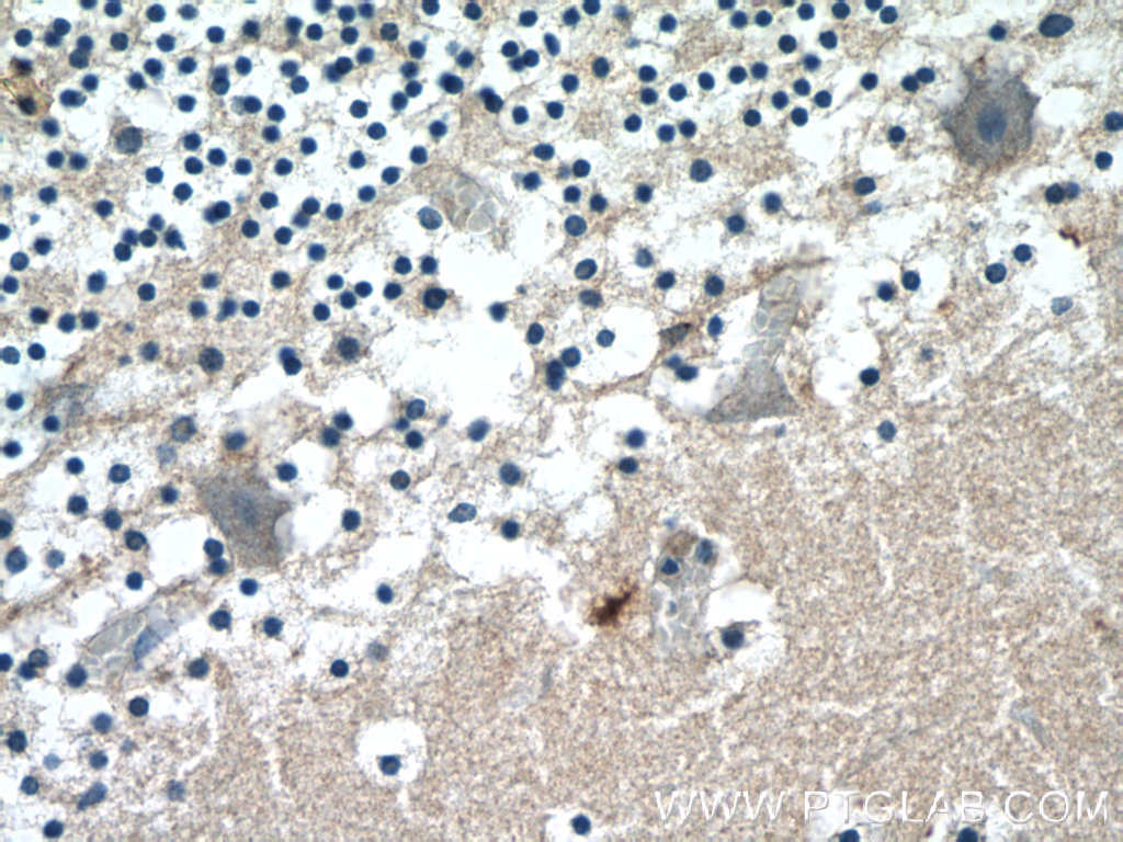 23909-1-AP;human cerebellum tissue