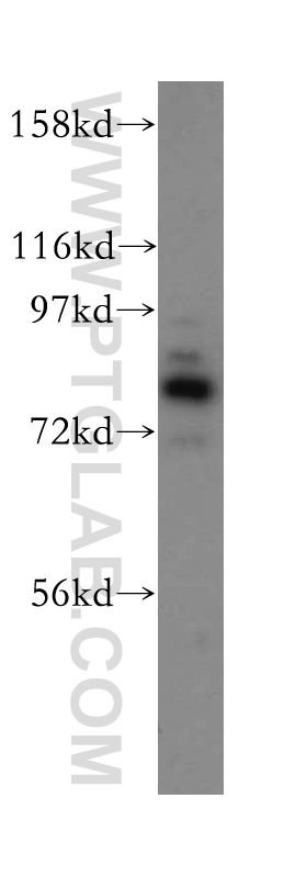 14631-1-AP;HeLa cell