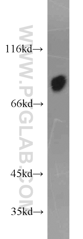 19494-1-AP;human blood tissue