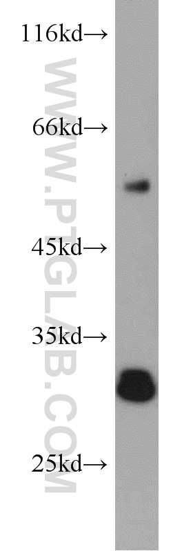 19522-1-AP;mouse liver tissue