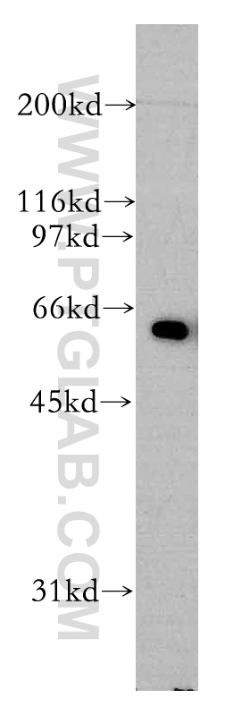 12670-1-AP;mouse testis tissue