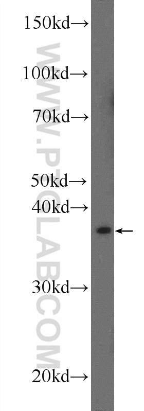 25723-1-AP;mouse testis tissue