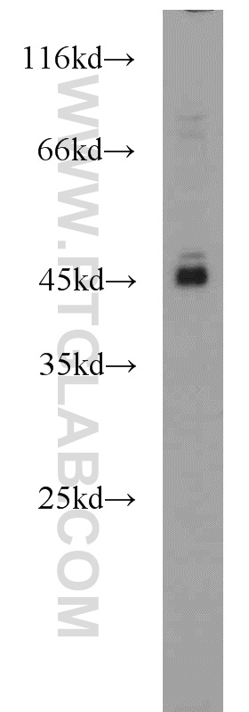 20590-1-AP;K-562 cells