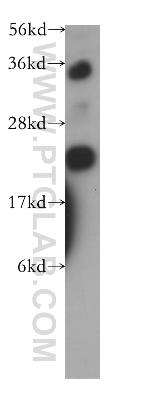 14978-1-AP;human heart tissue