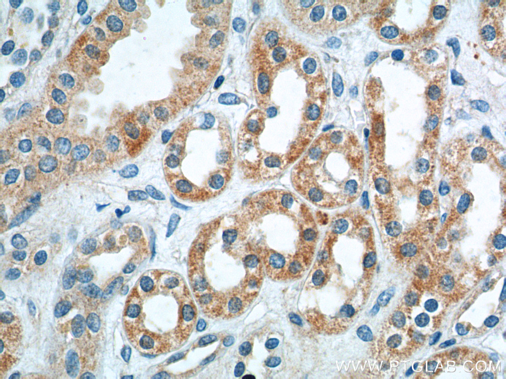 23042-1-AP;human kidney tissue