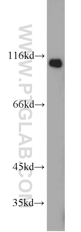 21972-1-AP;human liver tissue