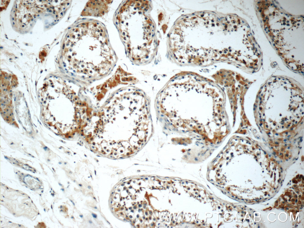 13480-1-AP;human testis tissue